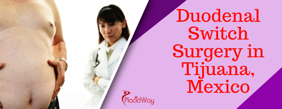 Duodenal Switch Surgery in Tijuana, Mexico
